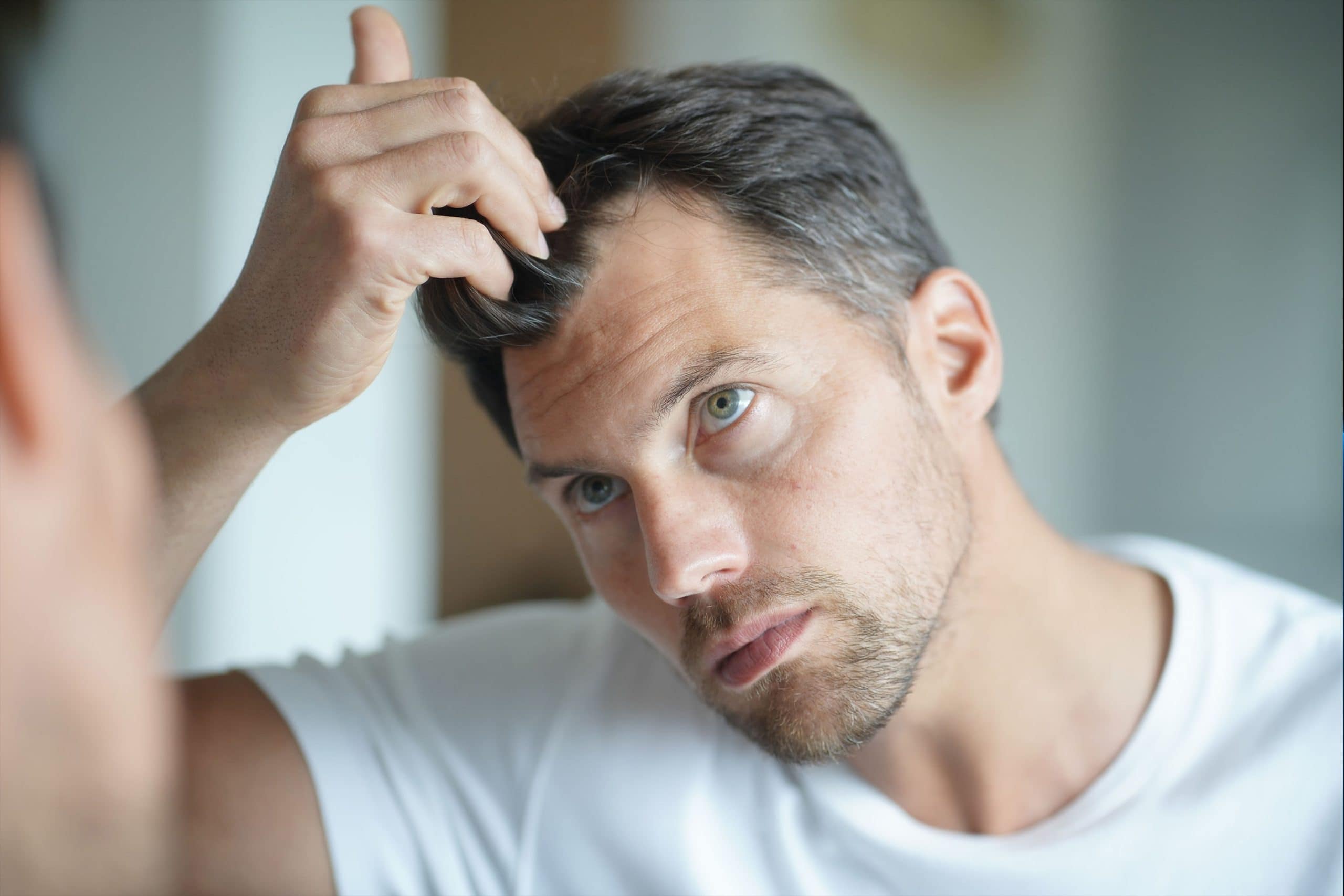 Common myths about hair loss