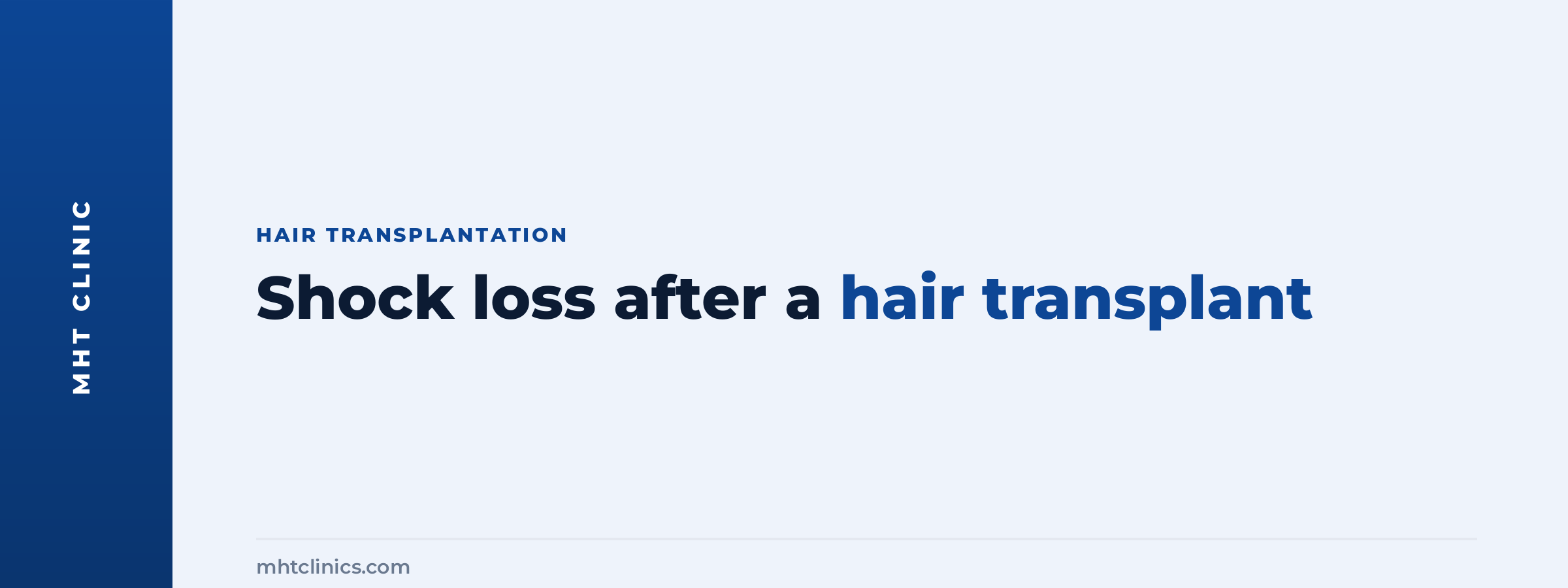 Shock loss after a hair transplant: why it happens and when it passes
