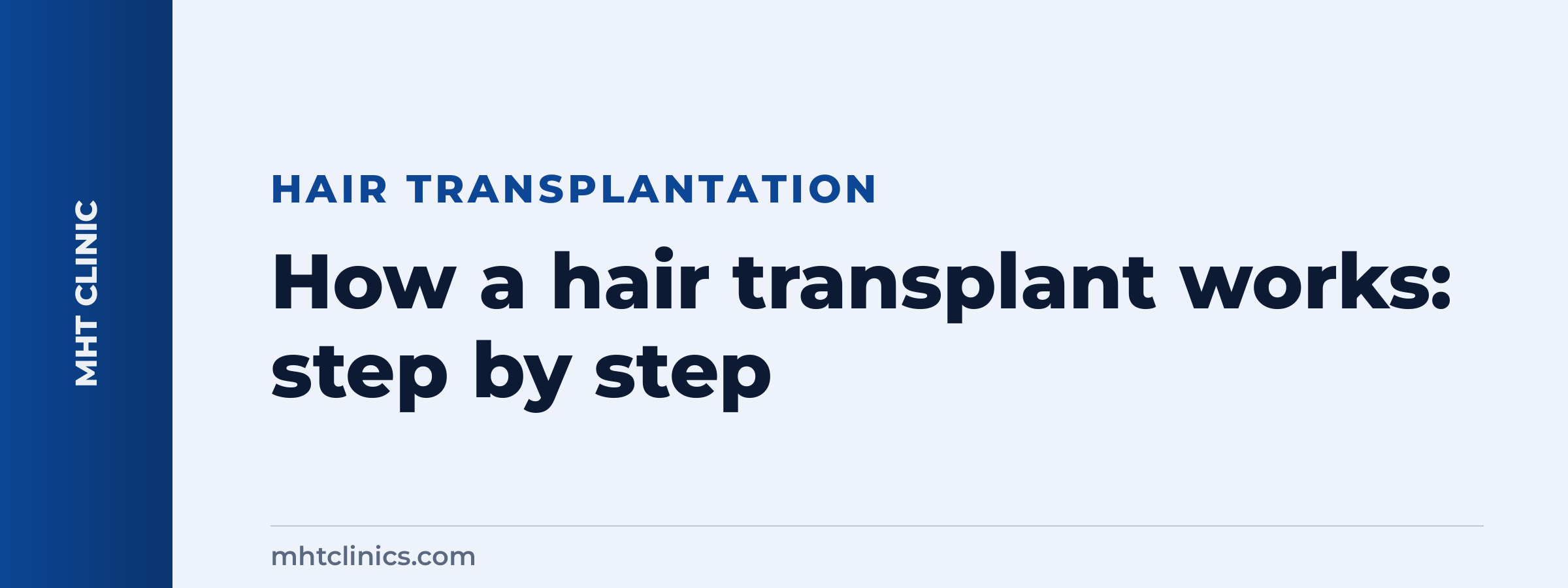 How a hair transplant works: step by step