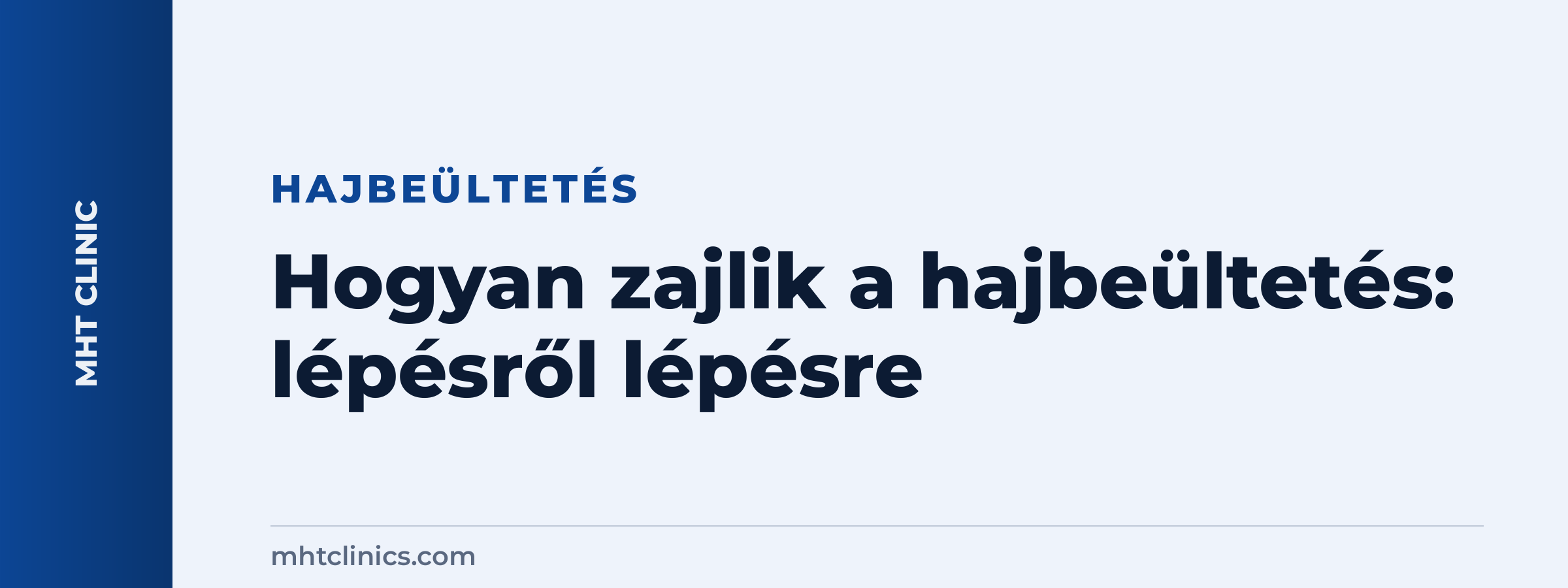Hogyan zajlik a hajbeültetés: lépésről lépésre