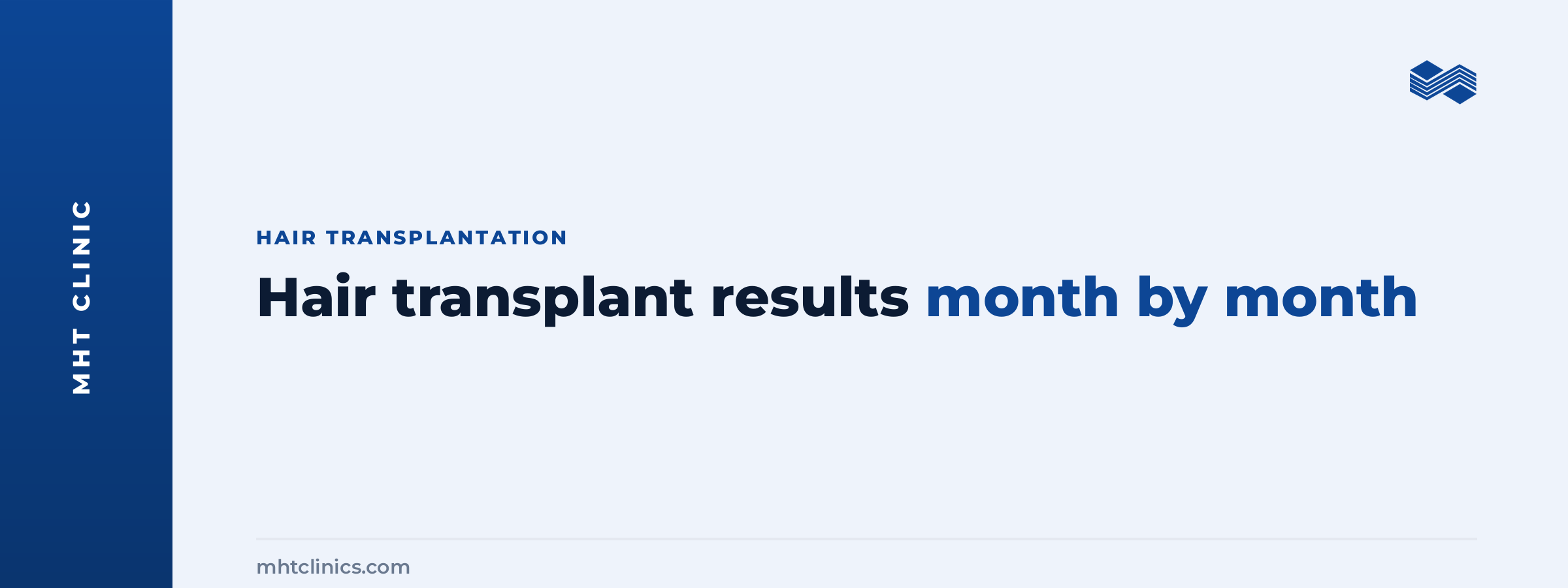 Hair transplant results month by month: the growth timeline