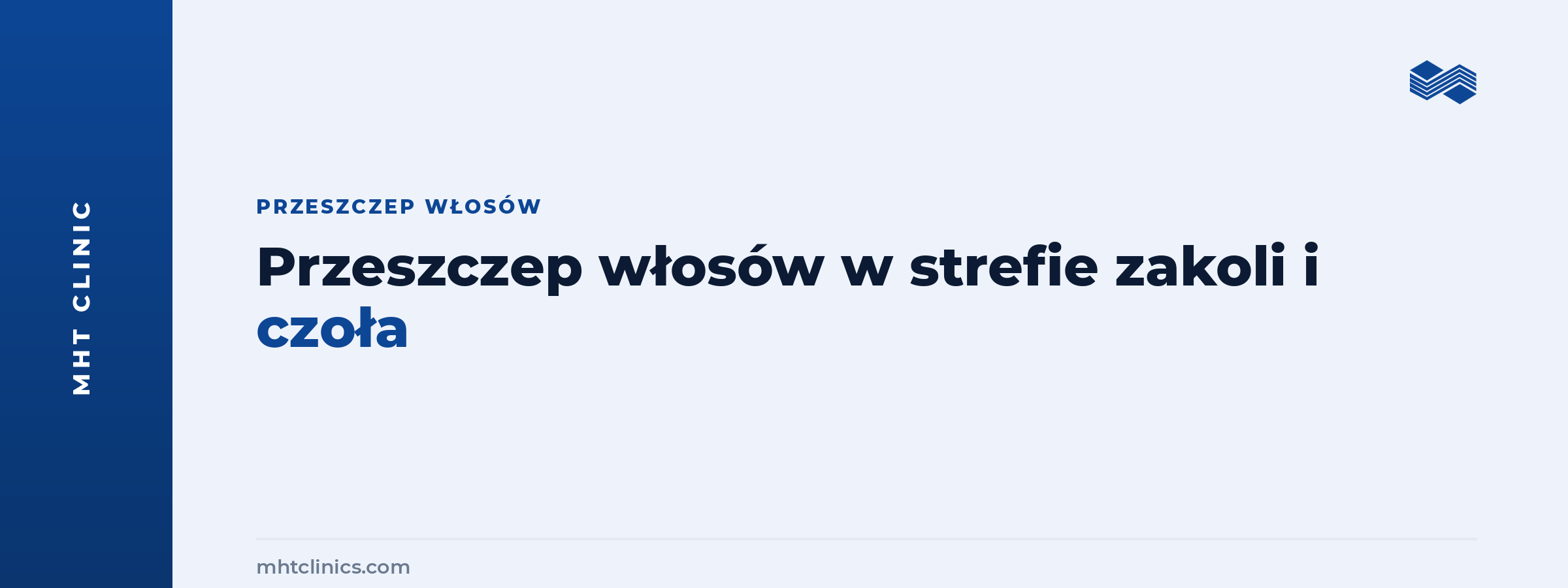 Przeszczep włosów w strefie zakoli i czoła: jak projektuje się linię włosów