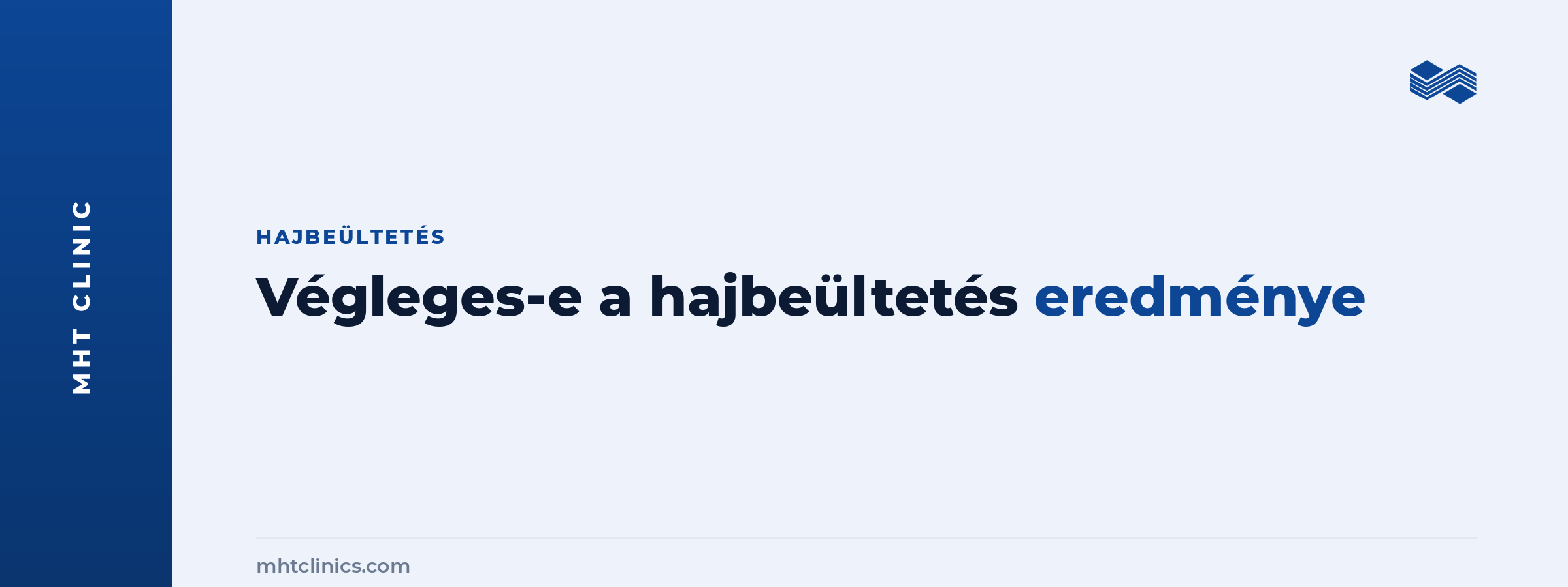 Végleges-e a hajbeültetés eredménye: mi marad meg és mi változik